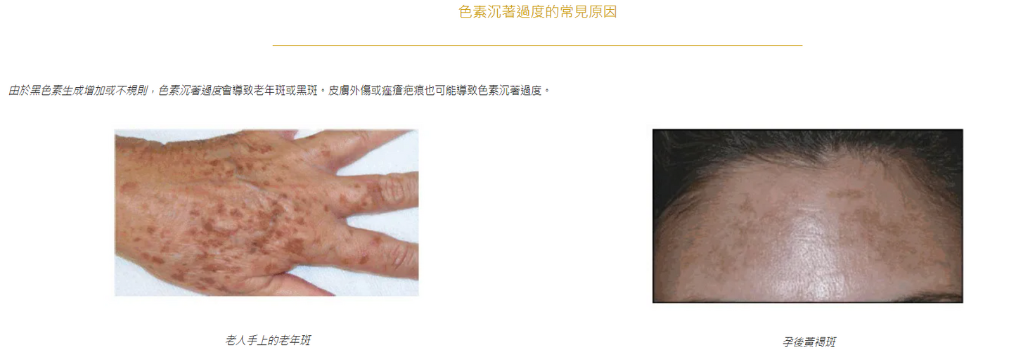 CHOLLEY 1006V 色斑標靶精華 Phytocell Harmonizer
