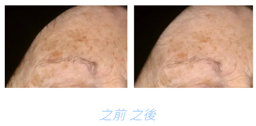 CHOLLEY 1016V 金至尊抗糖化緞亮ACE霜 Phytobiotech Satin Ace Cream